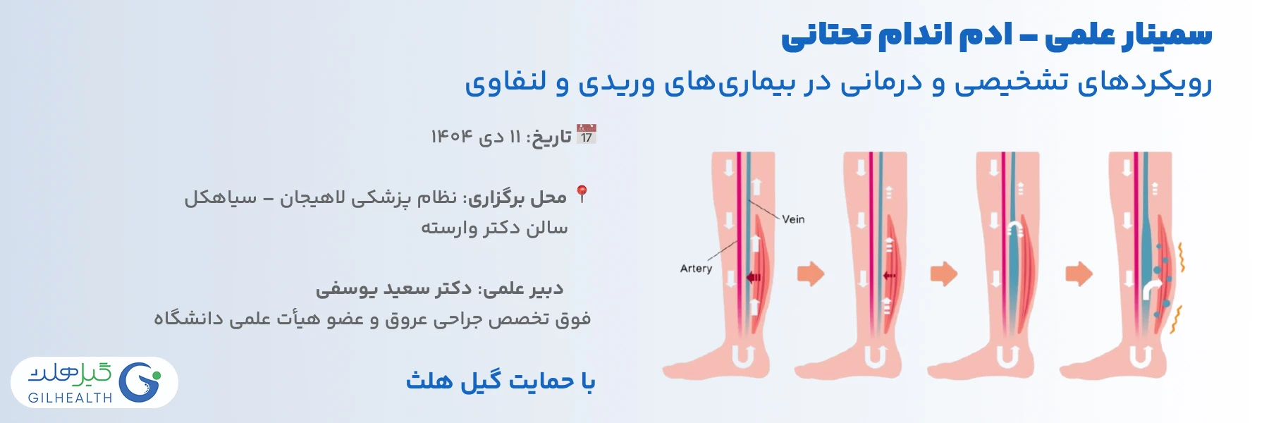 سمینار علمی ادم اندام تحتانی