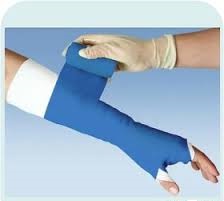 گچ (باند ارتوپدی) فایبرگلاس آرت کست