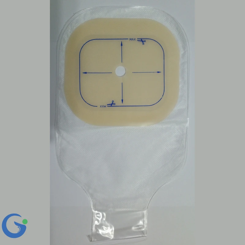 کیسه کلستومی بعد از عمل شفاف ته باز وللند WEP700